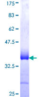 LMCD1 Protein - 12.5% SDS-PAGE Stained with Coomassie Blue.