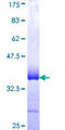 LMCD1 Protein - 12.5% SDS-PAGE Stained with Coomassie Blue.