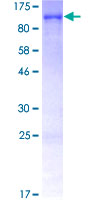 LMNA / Lamin A+C Protein - 12.5% SDS-PAGE of human LMNA stained with Coomassie Blue