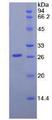 LMNB1 / Lamin B1 Protein - Recombinant  Lamin B1 By SDS-PAGE