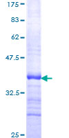 LMO1 Protein - 12.5% SDS-PAGE Stained with Coomassie Blue.