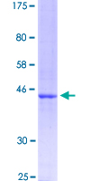 LMO1 Protein - 12.5% SDS-PAGE Stained with Coomassie Blue.