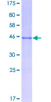 LMO2 Protein - 12.5% SDS-PAGE of human LMO2 stained with Coomassie Blue