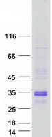 LMO2 Protein - Purified recombinant protein LMO2 was analyzed by SDS-PAGE gel and Coomassie Blue Staining