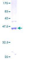 LMO4 Protein - 12.5% SDS-PAGE of human LMO4 stained with Coomassie Blue