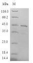 LMO4 Protein - (Tris-Glycine gel) Discontinuous SDS-PAGE (reduced) with 5% enrichment gel and 15% separation gel.