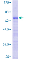 LMOD1 Protein - 12.5% SDS-PAGE of human LMOD1 stained with Coomassie Blue
