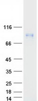 LMOD1 Protein - Purified recombinant protein LMOD1 was analyzed by SDS-PAGE gel and Coomassie Blue Staining