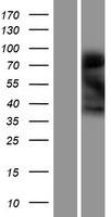 LMOD3 Protein - Western validation with an anti-DDK antibody * L: Control HEK293 lysate R: Over-expression lysate