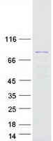 LMOD3 Protein - Purified recombinant protein LMOD3 was analyzed by SDS-PAGE gel and Coomassie Blue Staining