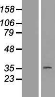 LMPB1 / PAQR8 Protein - Western validation with an anti-DDK antibody * L: Control HEK293 lysate R: Over-expression lysate