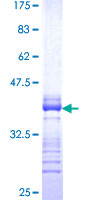 LMTK3 Protein - 12.5% SDS-PAGE Stained with Coomassie Blue.