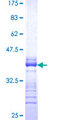LMTK3 Protein - 12.5% SDS-PAGE Stained with Coomassie Blue.