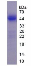 LMTK3 Protein - Active Lemur Tyrosine Kinase 3 (LMTK3) by SDS-PAGE