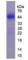 LMTK3 Protein - Active Lemur Tyrosine Kinase 3 (LMTK3) by SDS-PAGE