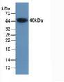 LMTK3 Protein - Active Lemur Tyrosine Kinase 3 (LMTK3) by WB