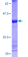 LMX1A Protein - 12.5% SDS-PAGE of human LMX1A stained with Coomassie Blue