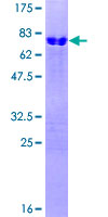 LMX1B Protein - 12.5% SDS-PAGE of human LMX1B stained with Coomassie Blue