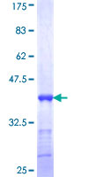 LMX1B Protein - 12.5% SDS-PAGE Stained with Coomassie Blue