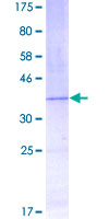 LNPEP Protein - 12.5% SDS-PAGE Stained with Coomassie Blue