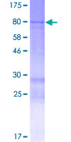 LNPK / KIAA1715 Protein - 12.5% SDS-PAGE of human KIAA1715 stained with Coomassie Blue