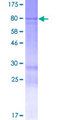 LNPK / KIAA1715 Protein - 12.5% SDS-PAGE of human KIAA1715 stained with Coomassie Blue