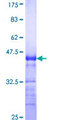 LNX1 / LNX Protein - 12.5% SDS-PAGE Stained with Coomassie Blue.