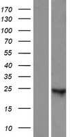 LOC100287718 Protein - Western validation with an anti-DDK antibody * L: Control HEK293 lysate R: Over-expression lysate