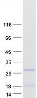 LOC283392 Protein - Purified recombinant protein LOC283392 was analyzed by SDS-PAGE gel and Coomassie Blue Staining