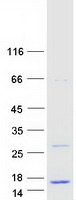 LOC284912 Protein - Purified recombinant protein LOC284912 was analyzed by SDS-PAGE gel and Coomassie Blue Staining