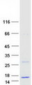 LOC284912 Protein - Purified recombinant protein LOC284912 was analyzed by SDS-PAGE gel and Coomassie Blue Staining