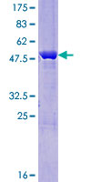 LOC285141 Protein - 12.5% SDS-PAGE of human LOC285141 stained with Coomassie Blue