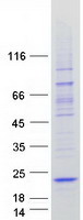 LOC389458 Protein - Purified recombinant protein LOC389458 was analyzed by SDS-PAGE gel and Coomassie Blue Staining