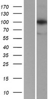 LONP1 / LON Protein - Western validation with an anti-DDK antibody * L: Control HEK293 lysate R: Over-expression lysate