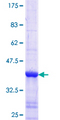 LONP1 / LON Protein - 12.5% SDS-PAGE Stained with Coomassie Blue.