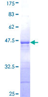 LONRF3 Protein - 12.5% SDS-PAGE Stained with Coomassie Blue.