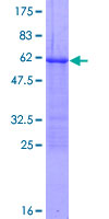 Loricrin Protein - 12.5% SDS-PAGE of human LOR stained with Coomassie Blue