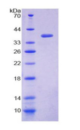 Loricrin Protein - Recombinant Loricrin By SDS-PAGE