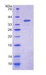 Loricrin Protein - Recombinant Loricrin By SDS-PAGE