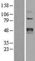 LOX / Lysyl Oxidase Protein - Western validation with an anti-DDK antibody * L: Control HEK293 lysate R: Over-expression lysate