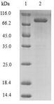 LOX / Lysyl Oxidase Protein - (Tris-Glycine gel) Discontinuous SDS-PAGE (reduced) with 5% enrichment gel and 15% separation gel.
