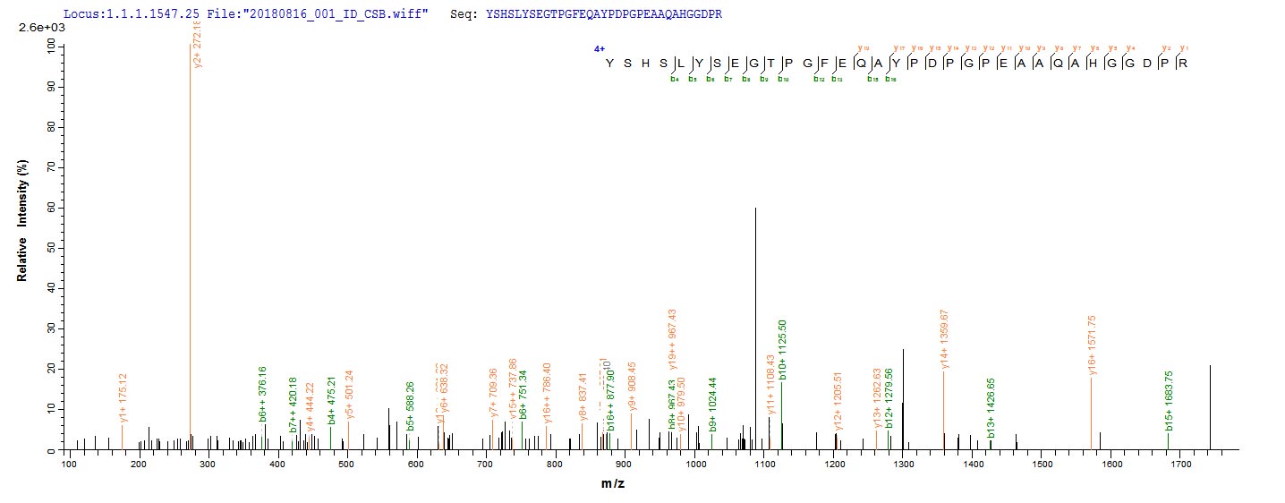 LOXL1 Protein - Based on the SEQUEST from database of E.coli host and target protein, the LC-MS/MS Analysis result of Recombinant Human Lysyl oxidase homolog 1(LOXL1) could indicate that this peptide derived from E.coli-expressed Homo sapiens (Human) LOXL1.