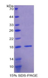 LOXL1 Protein - Recombinant Lysyl Oxidase Like Protein 1 By SDS-PAGE