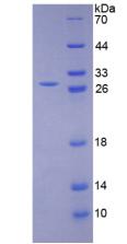 LOXL1 Protein - Recombinant Lysyl Oxidase Like Protein 1 By SDS-PAGE