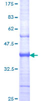 LOXL2 Protein - 12.5% SDS-PAGE Stained with Coomassie Blue.