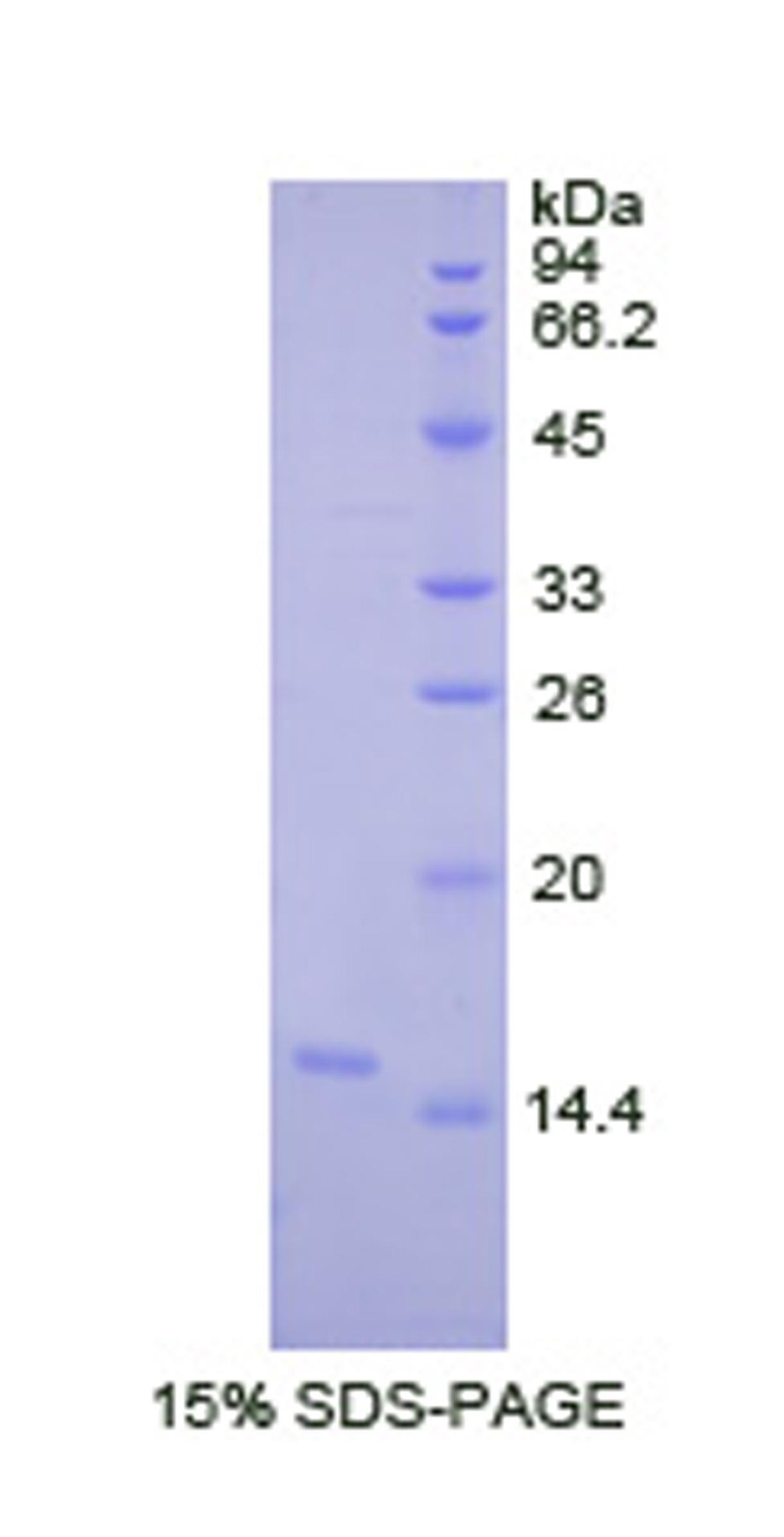 LOXL2 Protein - Recombinant Lysyl Oxidase Like Protein 2 By SDS-PAGE