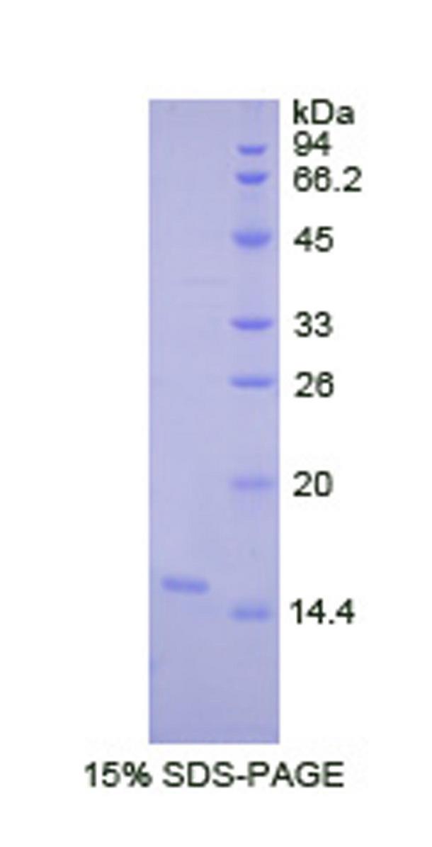 LOXL2 Protein - Recombinant Lysyl Oxidase Like Protein 2 By SDS-PAGE