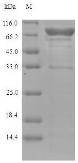 LOXL4 / LOXC Protein - (Tris-Glycine gel) Discontinuous SDS-PAGE (reduced) with 5% enrichment gel and 15% separation gel.