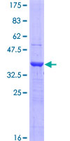 LOXL4 / LOXC Protein - 12.5% SDS-PAGE Stained with Coomassie Blue.