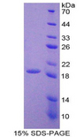 LOXL4 / LOXC Protein - Recombinant Lysyl Oxidase Like Protein 4 By SDS-PAGE